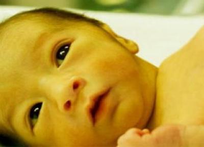 ترنجبین برای نوزاد، باوری غلط برای درمان زردی