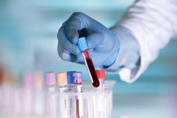 طراحی تست خون برای تشخیص زودهنگام سرطان، درمان بر اساس ژنتیک فرد